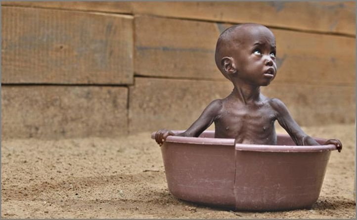 these-10-countries-starving-to-death-will-make-you-think-twice-about