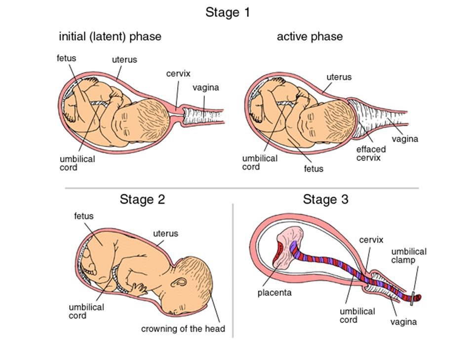 cardinal movements during stages of labor