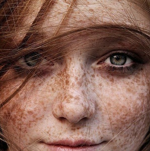 These Mesmerising Photos Of People With Freckles Show That Beauty Is ...