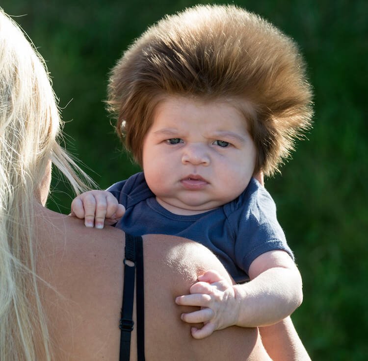 3 Month Old Baby Hair Not Growing