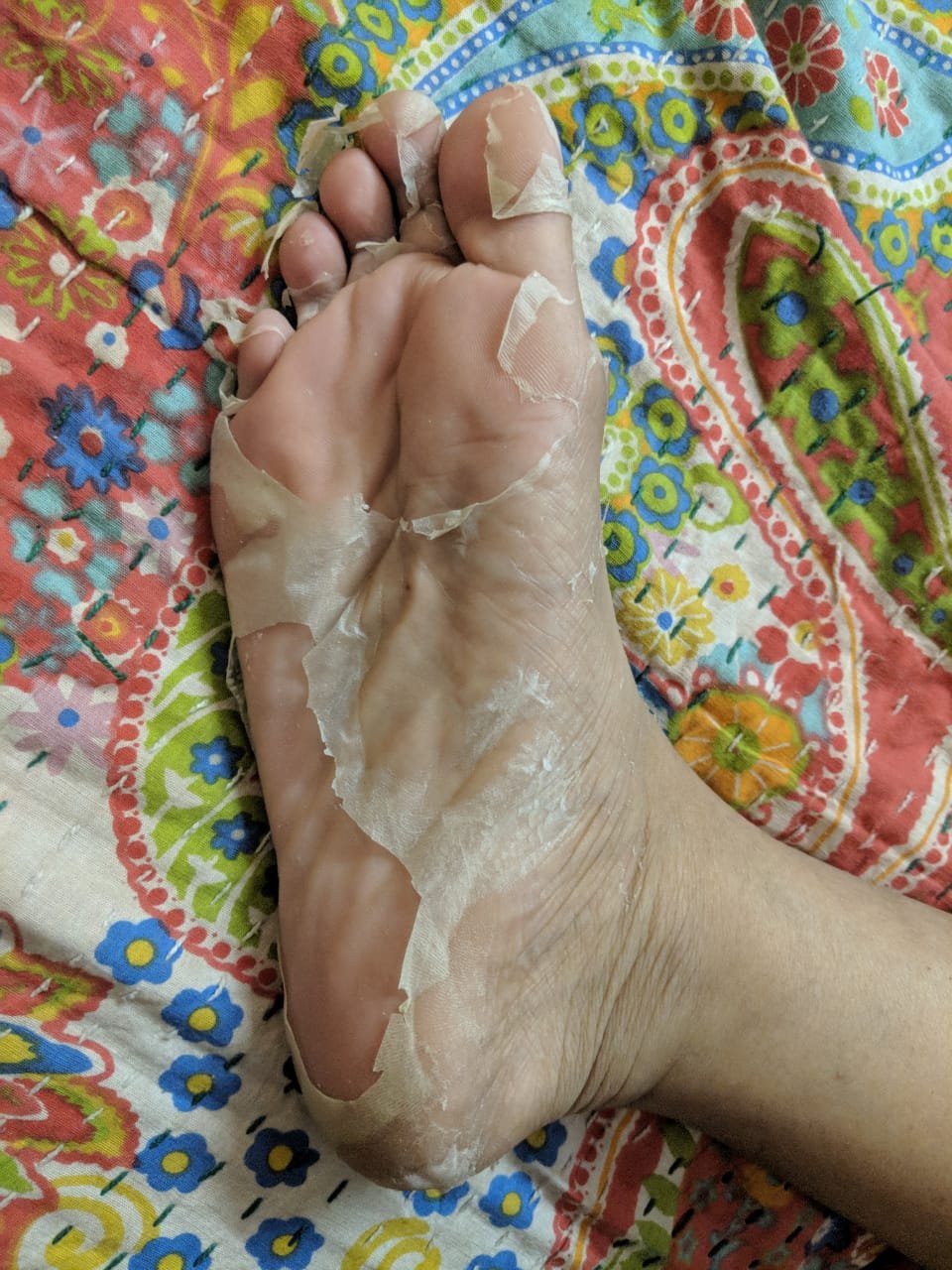 dead skin foot peeler