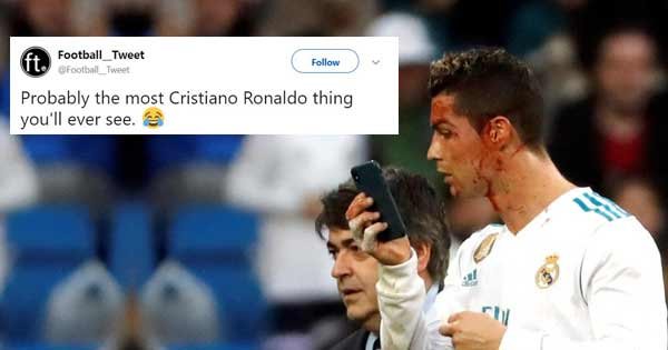Ronaldo Used The Physio’s Phone Camera To Check His Bloodied Face